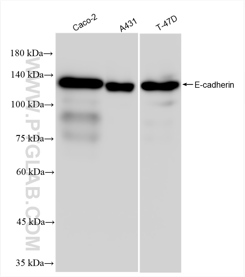 Western Blot (WB) analysis of various lysates using E-cadherin Recombinant antibody (80541-7-RR)