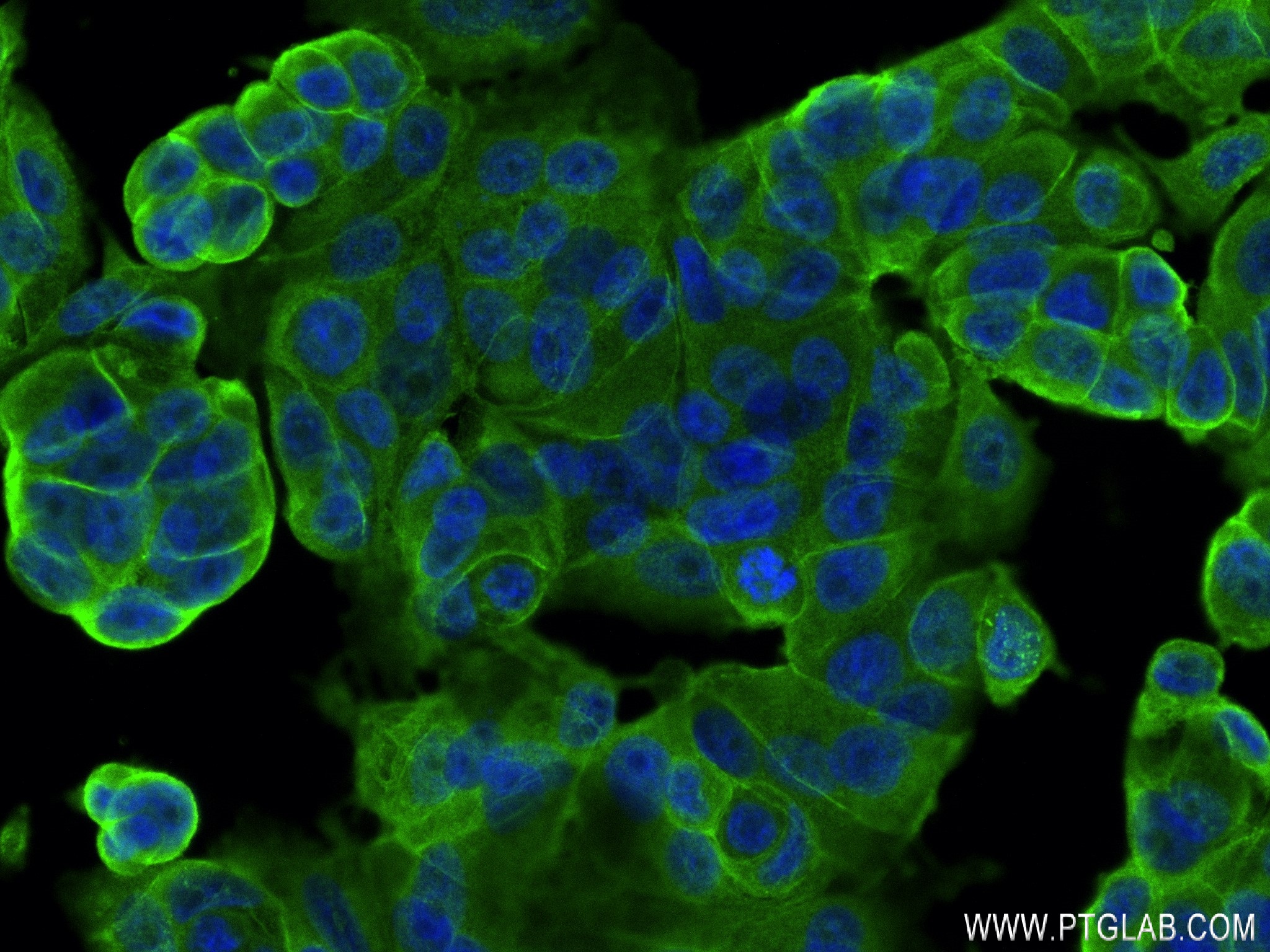 Immunofluorescence (IF) / fluorescent staining of MCF-7 cells using E-cadherin Recombinant antibody (80541-9-RR)