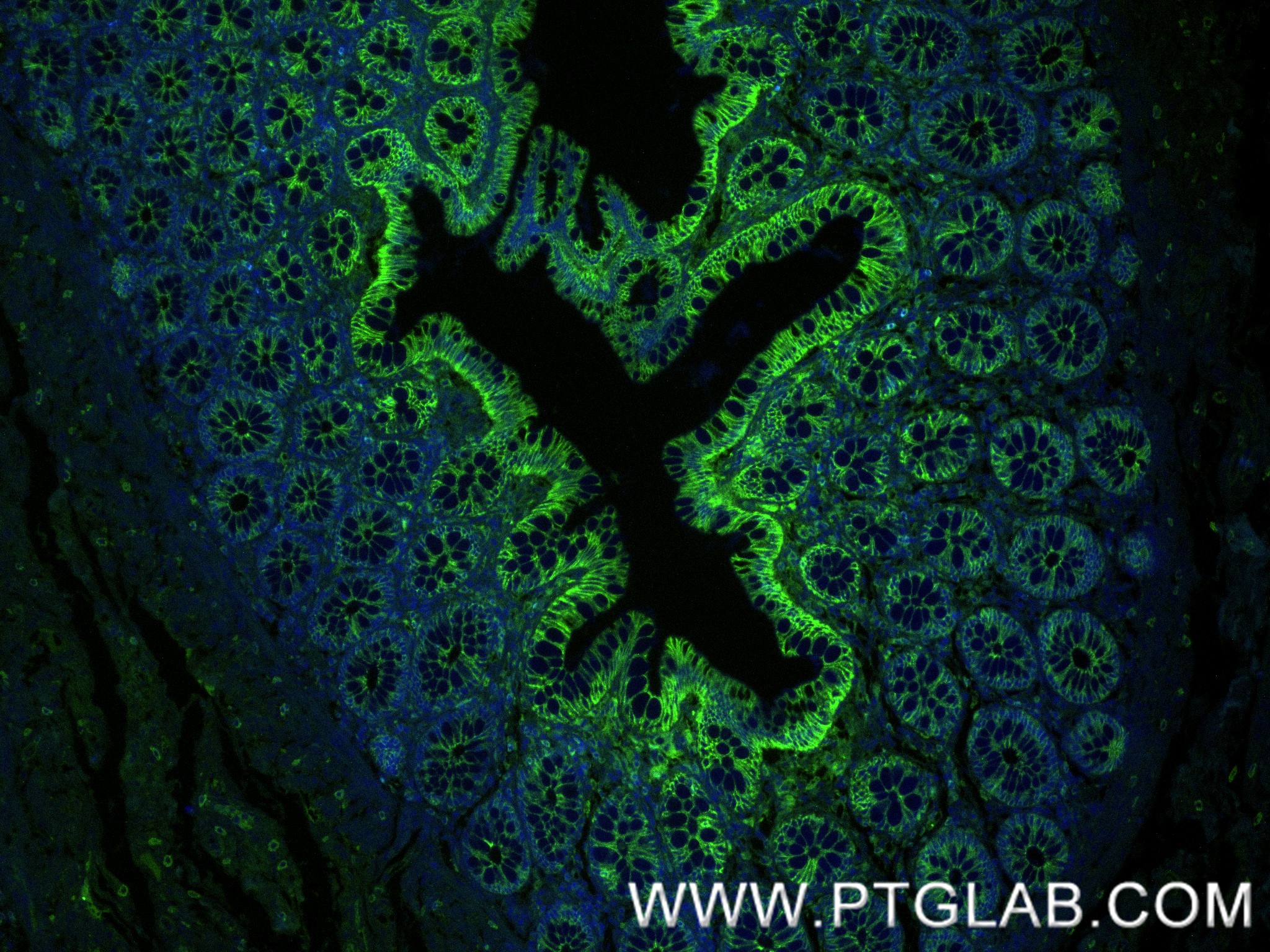 Immunofluorescence (IF) / fluorescent staining of human colon tissue using E-cadherin Recombinant monoclonal antibody (80541-9-RR)