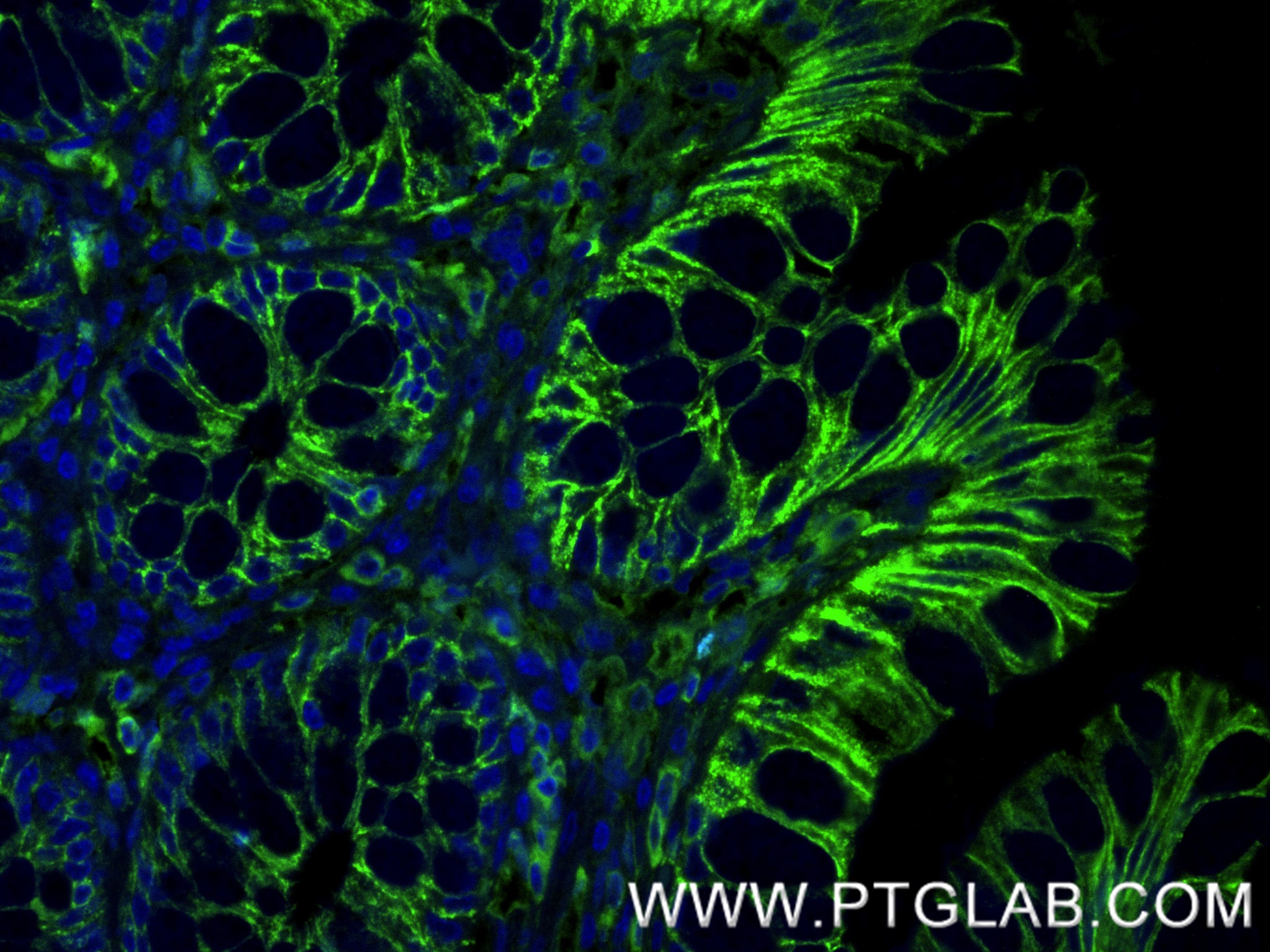 Immunofluorescence (IF) / fluorescent staining of human colon tissue using E-cadherin Recombinant monoclonal antibody (80541-9-RR)