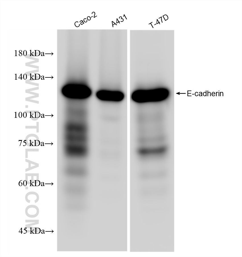 Western Blot (WB) analysis of various lysates using E-cadherin Recombinant antibody (80541-9-RR)
