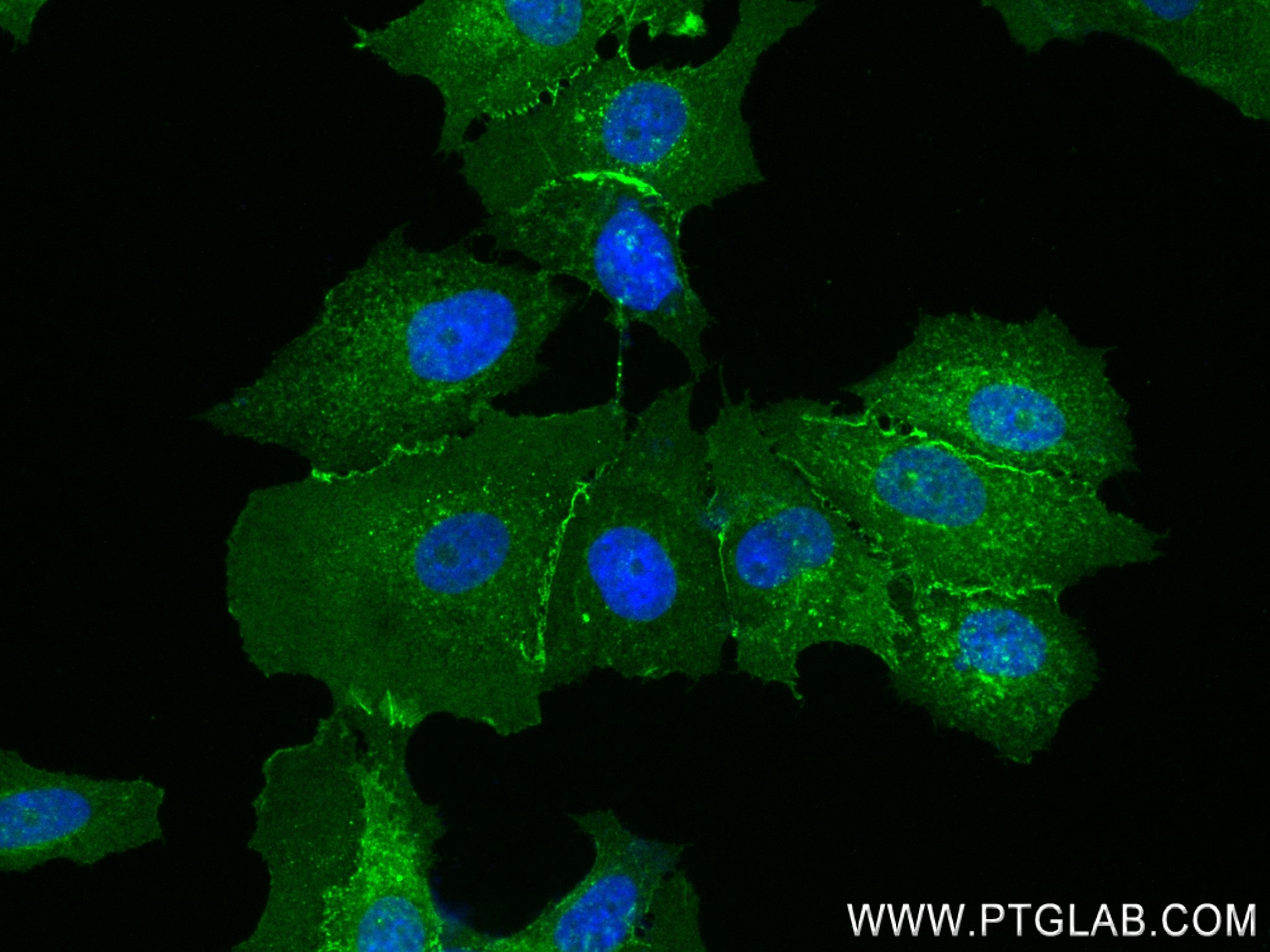 Immunofluorescence (IF) / fluorescent staining of MCF-7 cells using E-cadherin Recombinant antibody (83991-4-RR)