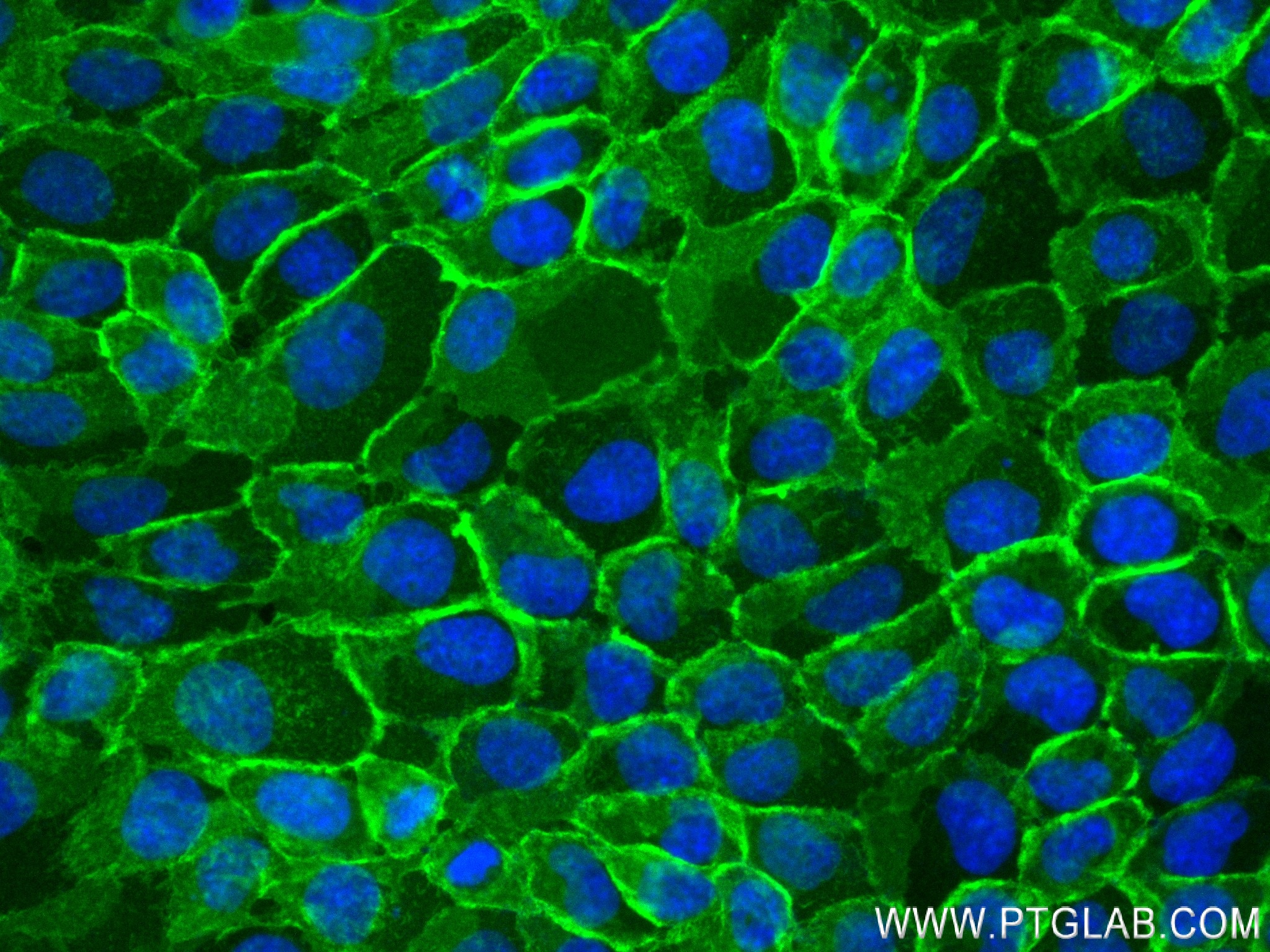 Immunofluorescence (IF) / fluorescent staining of A431 cells using E-cadherin Recombinant antibody (83991-4-RR)