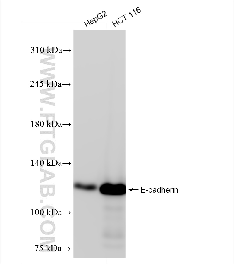 Western Blot (WB) analysis of various lysates using E-cadherin Recombinant antibody (83991-4-RR)