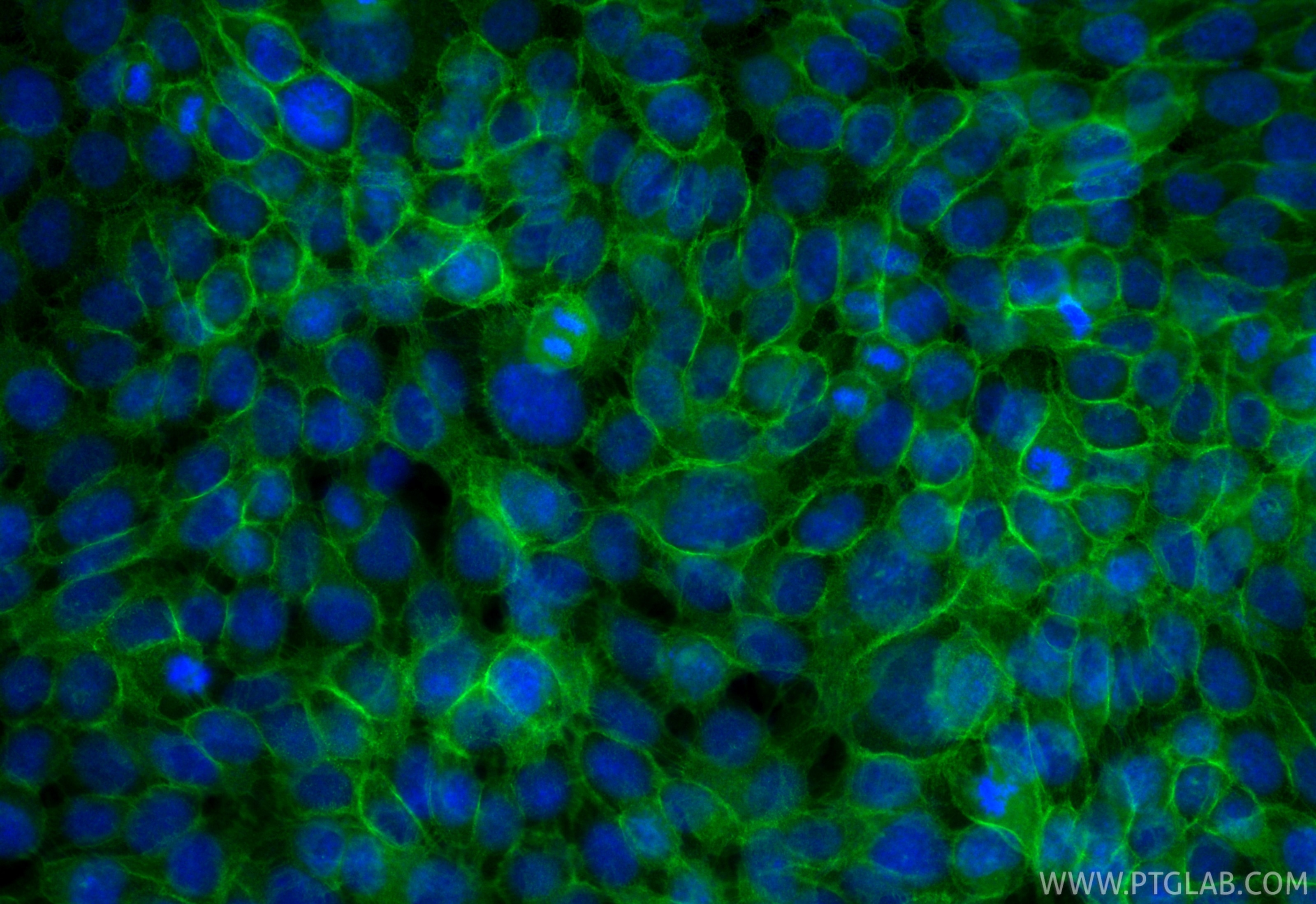 Immunofluorescence (IF) / fluorescent staining of A431 cells using CoraLite® Plus 488-conjugated E-cadherin Polyclona (CL488-20874)