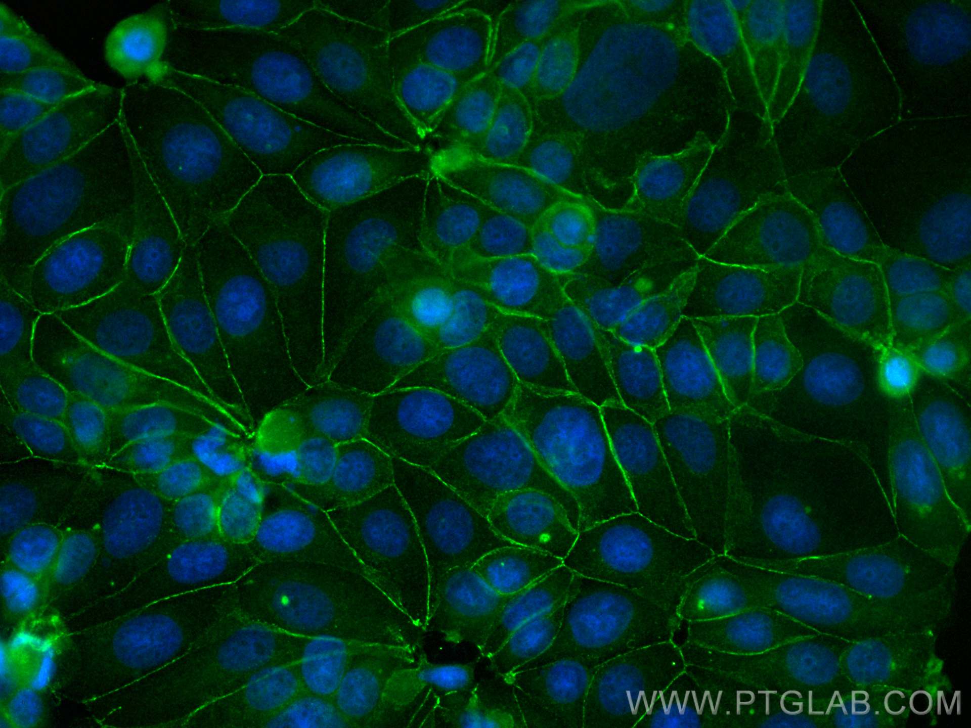 Immunofluorescence (IF) / fluorescent staining of MCF-7 cells using CoraLite® Plus 488-conjugated E-cadherin Monoclona (CL488-60335)