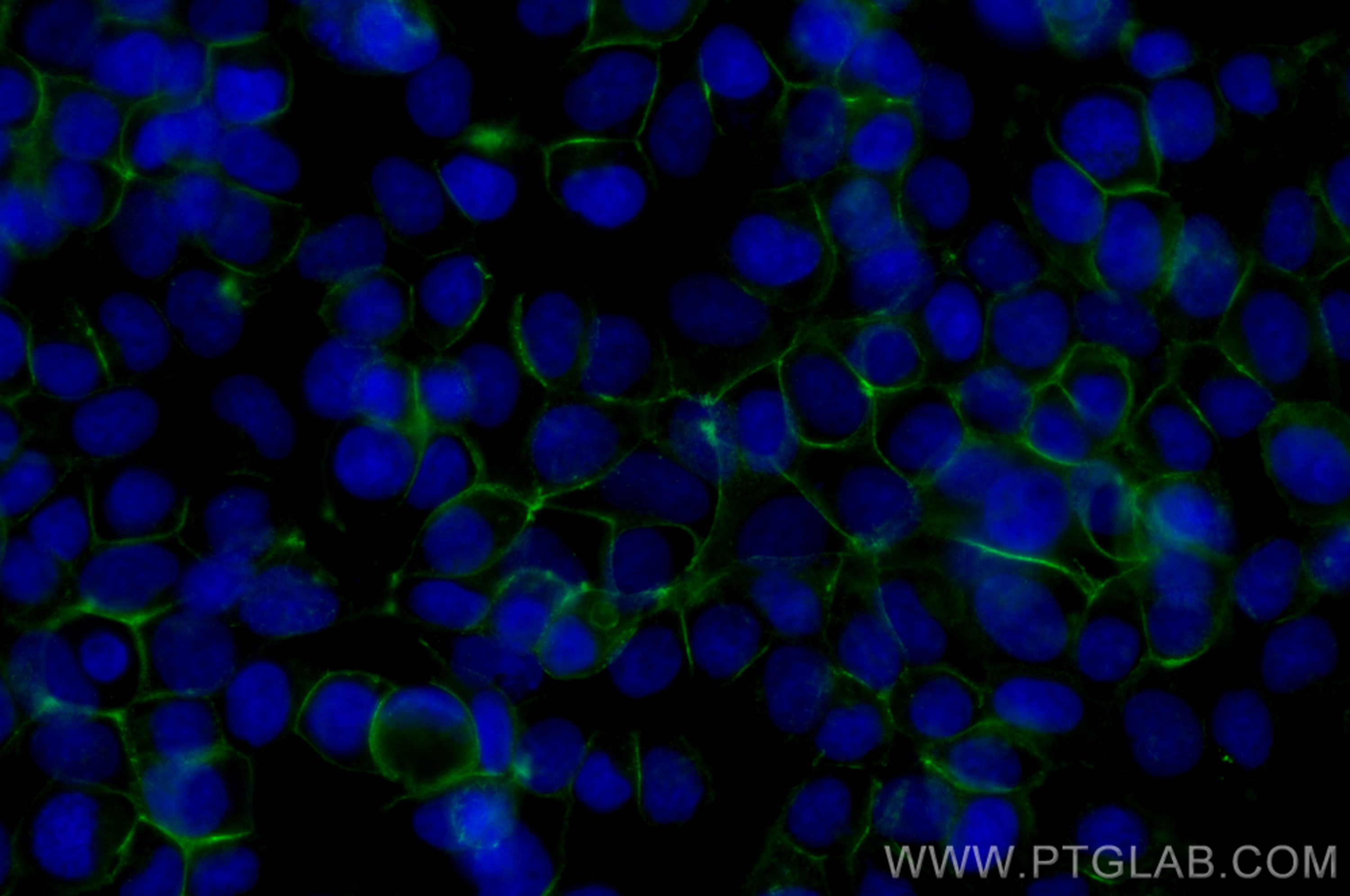 Immunofluorescence (IF) / fluorescent staining of MCF-7 cells using CoraLite® Plus 488-conjugated E-cadherin Recombina (CL488-80541-5)