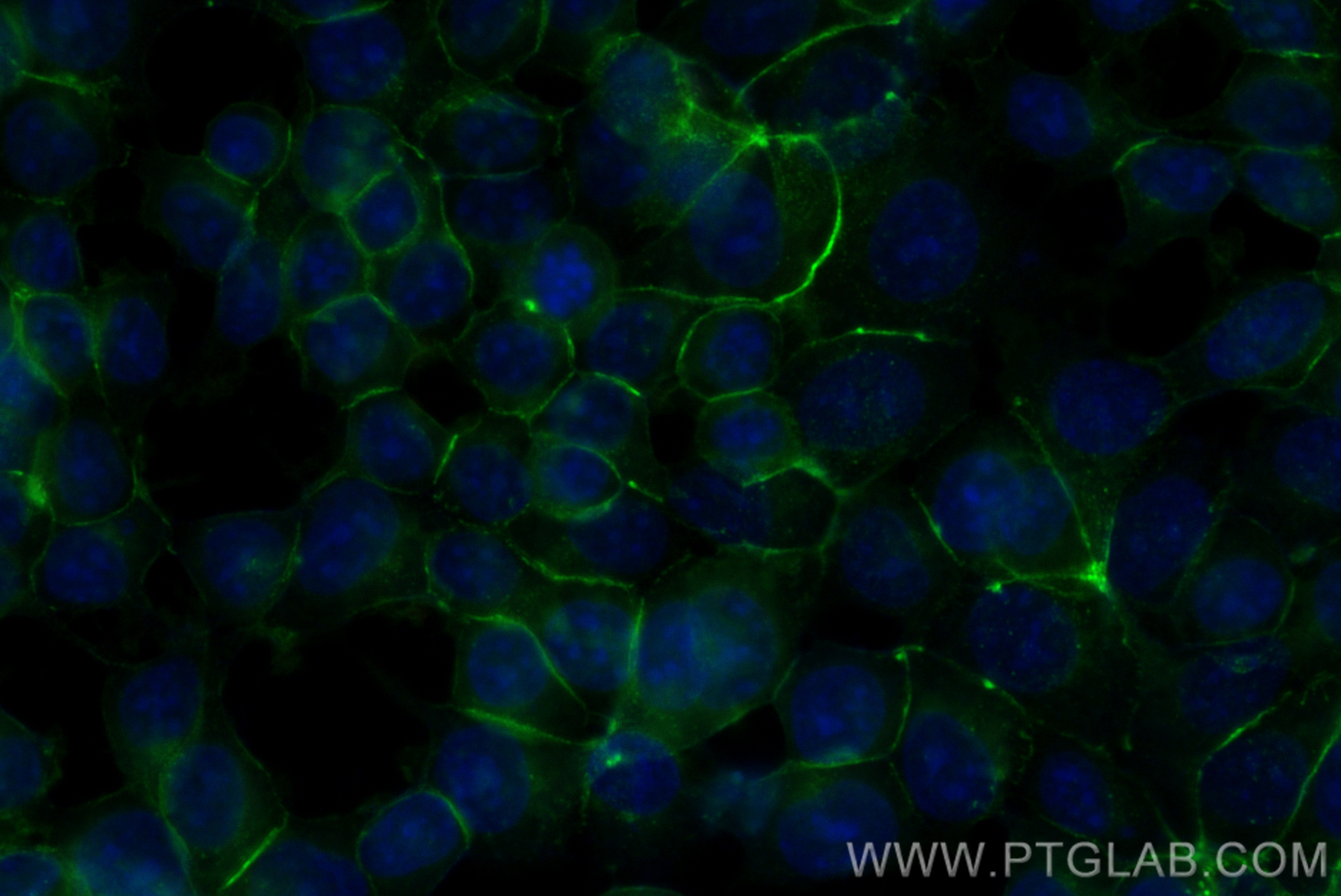 Immunofluorescence (IF) / fluorescent staining of MCF-7 cells using CoraLite® Plus 488-conjugated E-cadherin Recombina (CL488-80541-7)