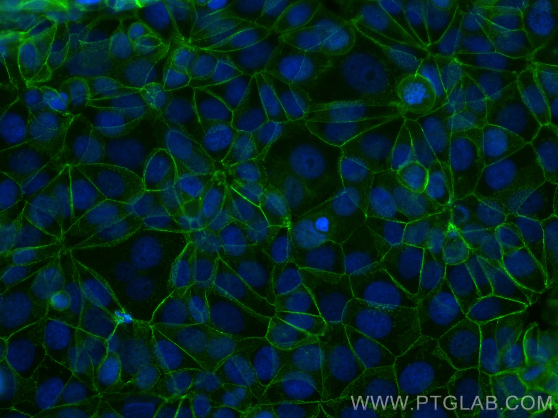 Immunofluorescence (IF) / fluorescent staining of MCF-7 cells using CoraLite® Plus 488-conjugated E-cadherin Recombina (CL488-83991-4)