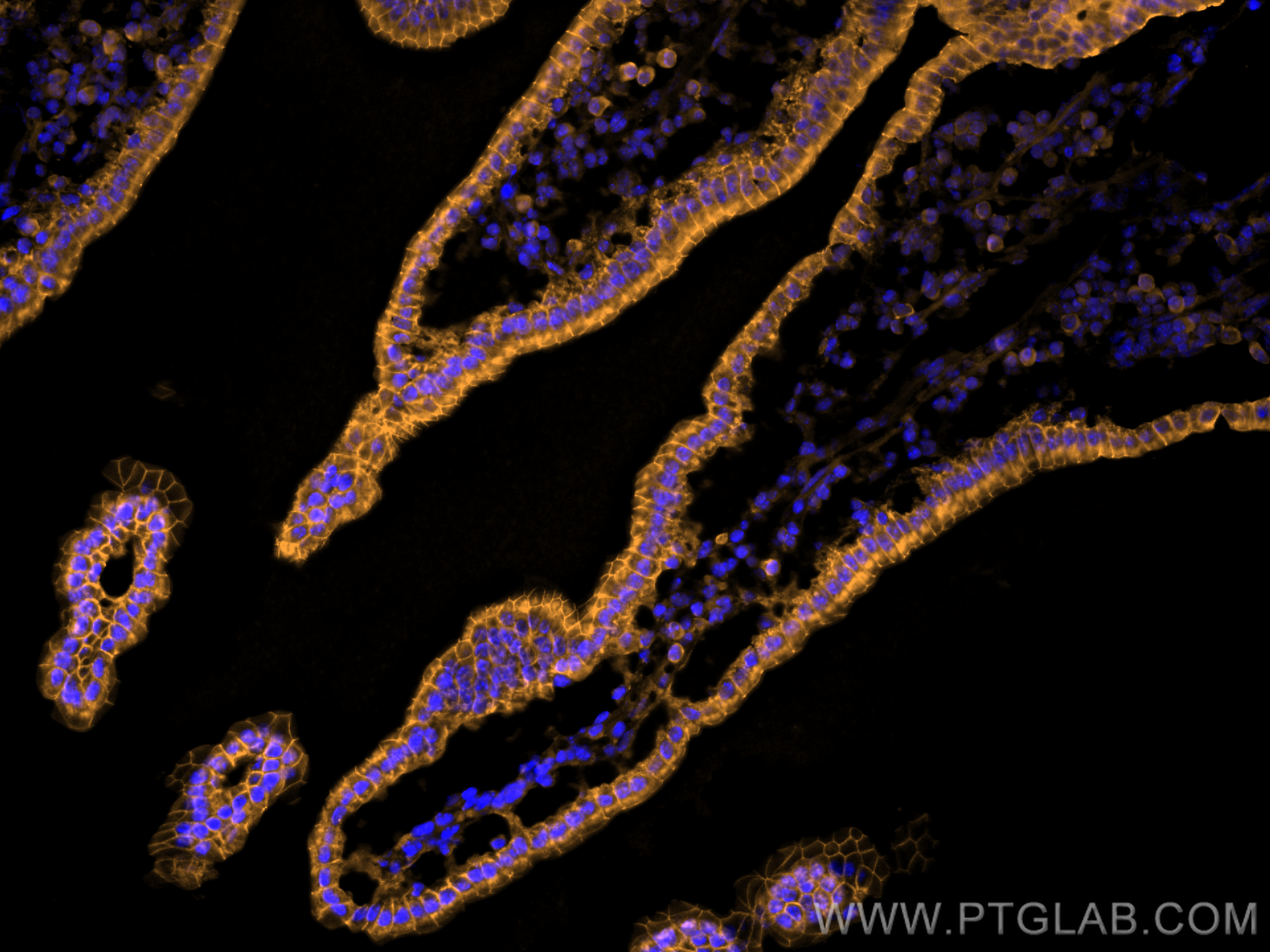Immunofluorescence (IF) / fluorescent staining of mouse small intestine tissue using CoraLite®555-conjugated E-cadherin Monoclonal anti (CL555-60335)