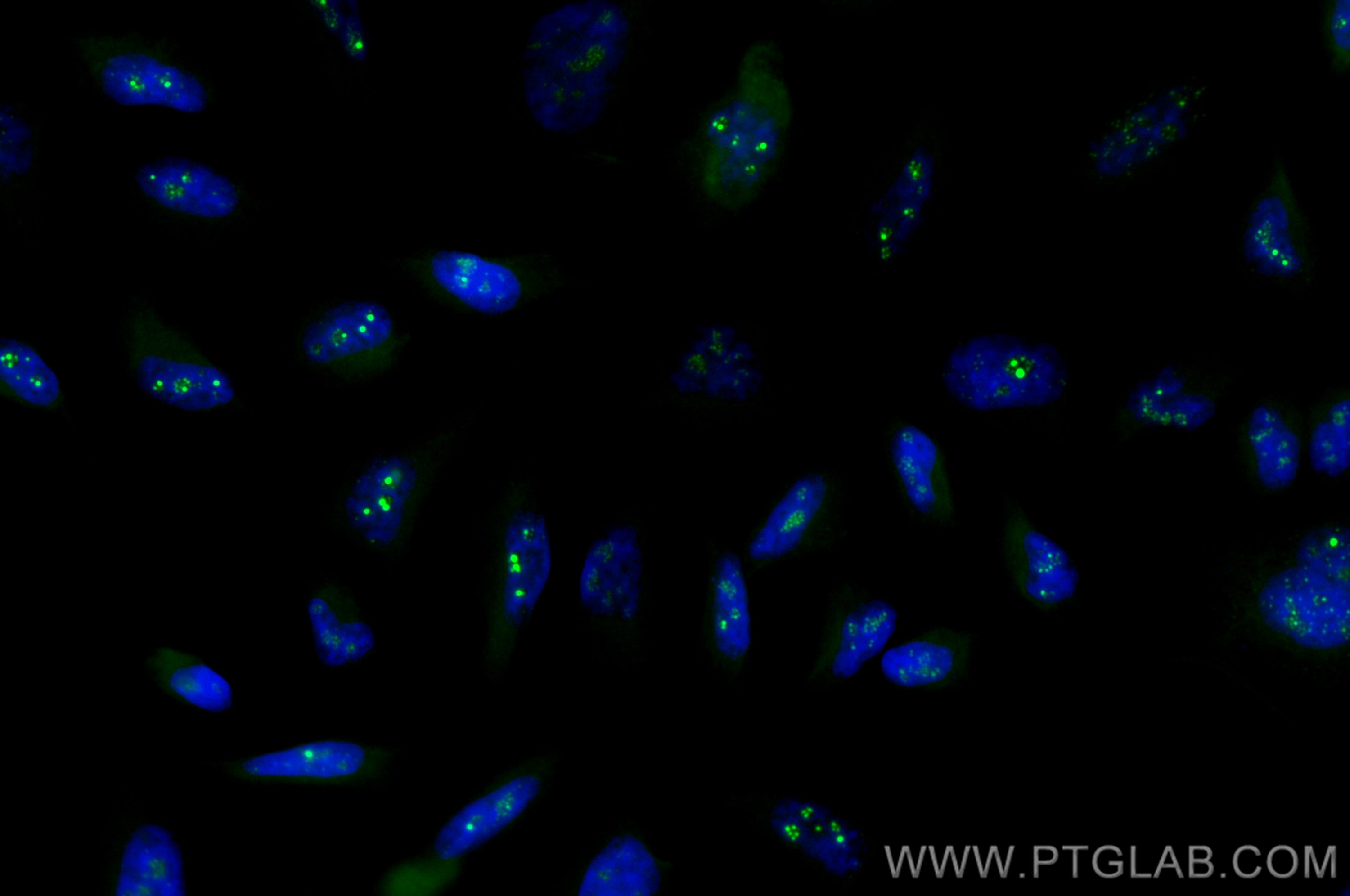 Immunofluorescence (IF) / fluorescent staining of HeLa cells using CoraLite® Plus 488-conjugated E2F7 Recombinant ant (CL488-82887)