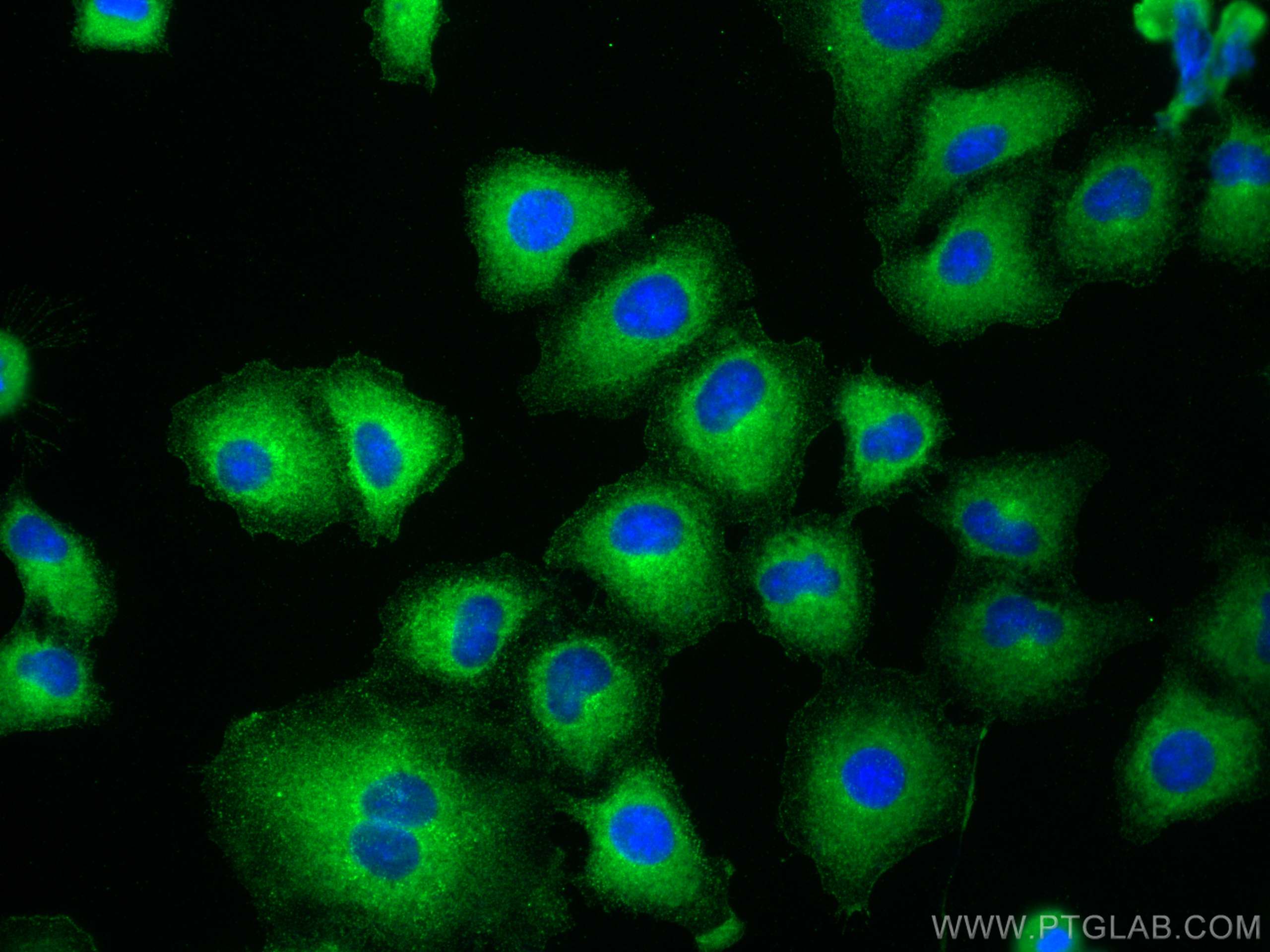 Immunofluorescence (IF) / fluorescent staining of A549 cells using EBP50/NHERF-1 Polyclonal antibody (29771-1-AP)