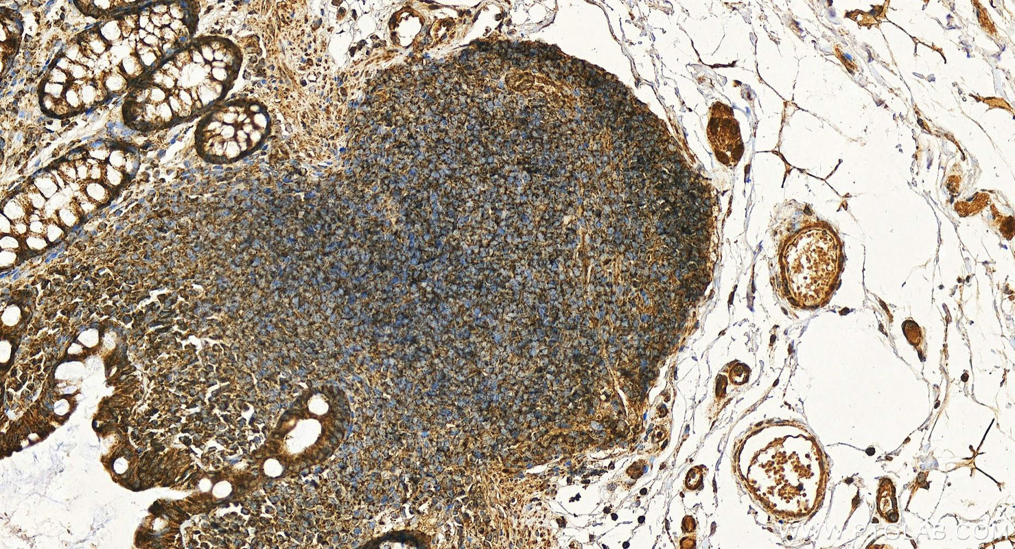 Immunohistochemistry (IHC) staining of human colon tissue using ECH1 Polyclonal antibody (11385-1-AP)