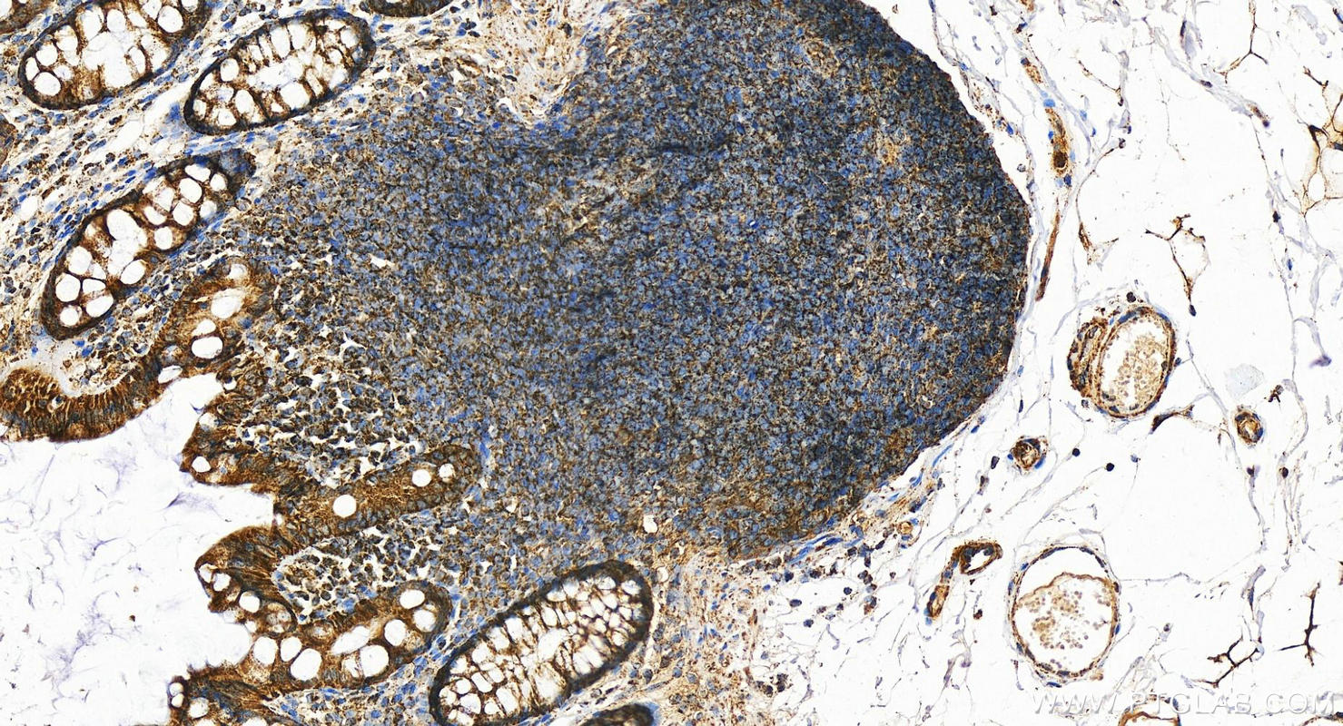 Immunohistochemistry (IHC) staining of human colon tissue using ECHS1 Polyclonal antibody (11305-1-AP)