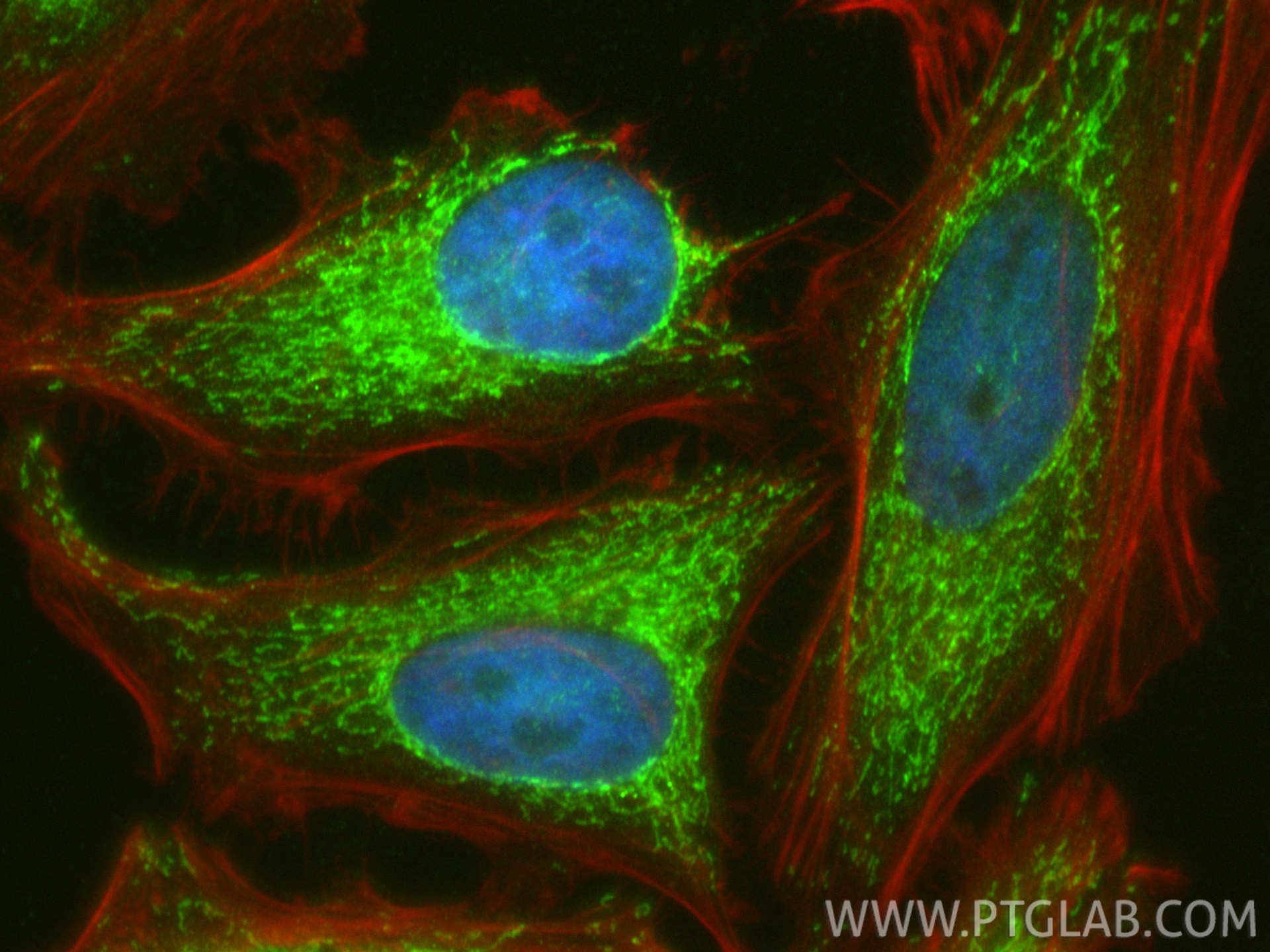 Immunofluorescence (IF) / fluorescent staining of HeLa cells using ECHS1 Polyclonal antibody (11305-1-AP)