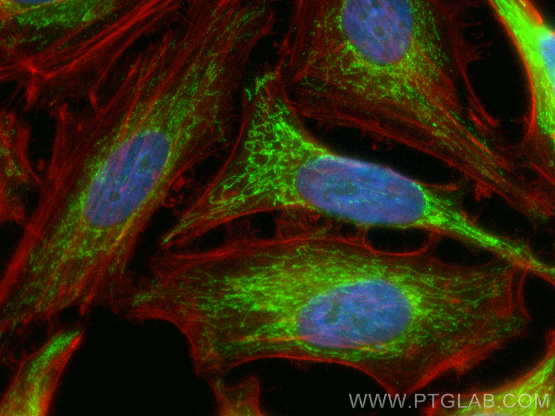 Immunofluorescence (IF) / fluorescent staining of HeLa cells using CoraLite® Plus 488-conjugated ECHS1 Recombinant an (CL488-81611)