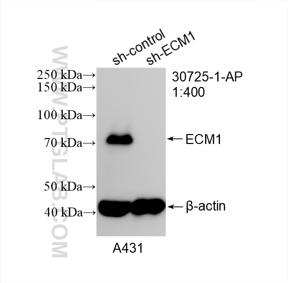 Western Blot (WB) analysis of A431 cells using ECM1 Polyclonal antibody (30725-1-AP)