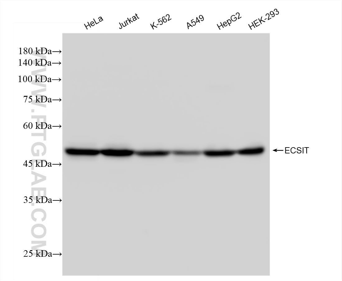Western Blot (WB) analysis of various lysates using ECSIT Recombinant antibody (83295-1-RR)