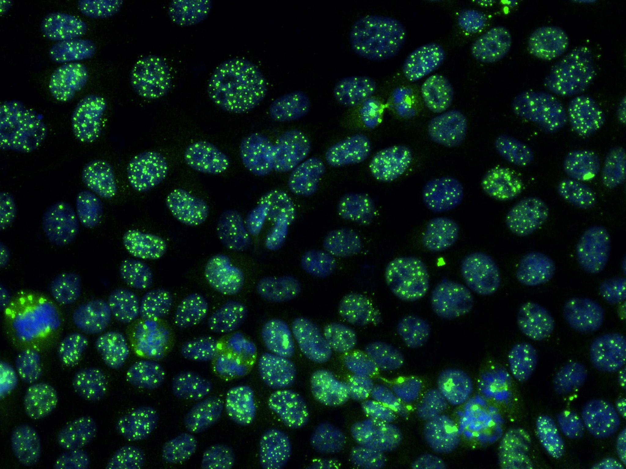 Immunofluorescence (IF) / fluorescent staining of A431 cells using ECSIT Recombinant antibody (83295-5-RR)