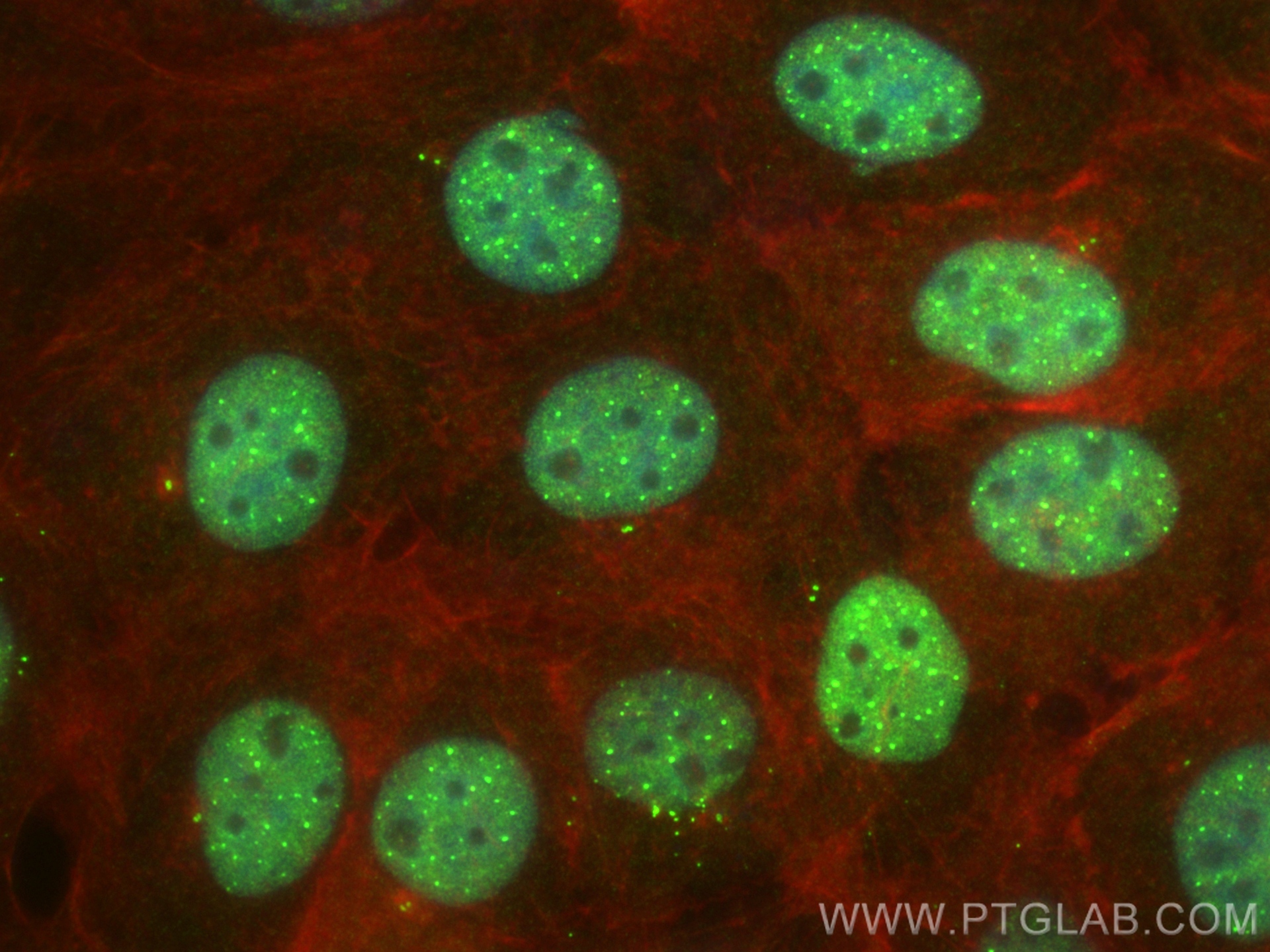 Immunofluorescence (IF) / fluorescent staining of A431 cells using ECSIT Recombinant antibody (83295-5-RR)