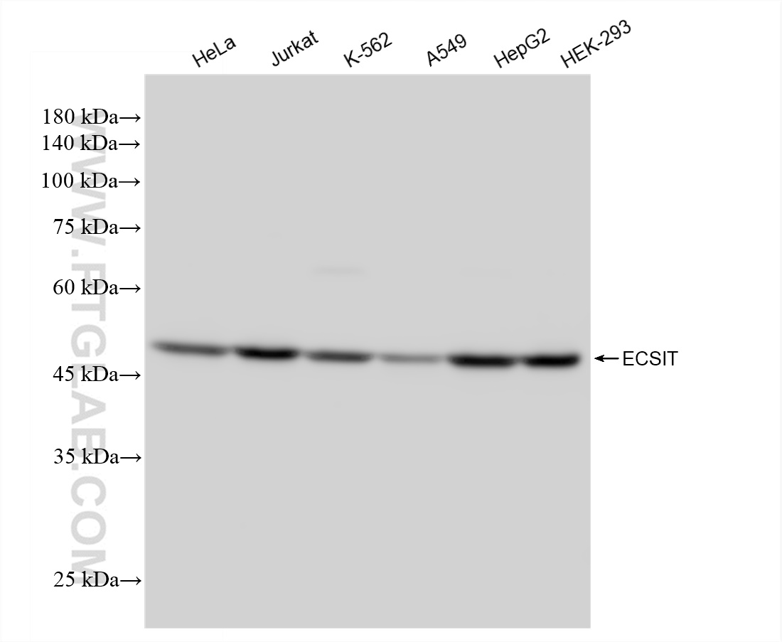Western Blot (WB) analysis of various lysates using ECSIT Recombinant antibody (83295-5-RR)