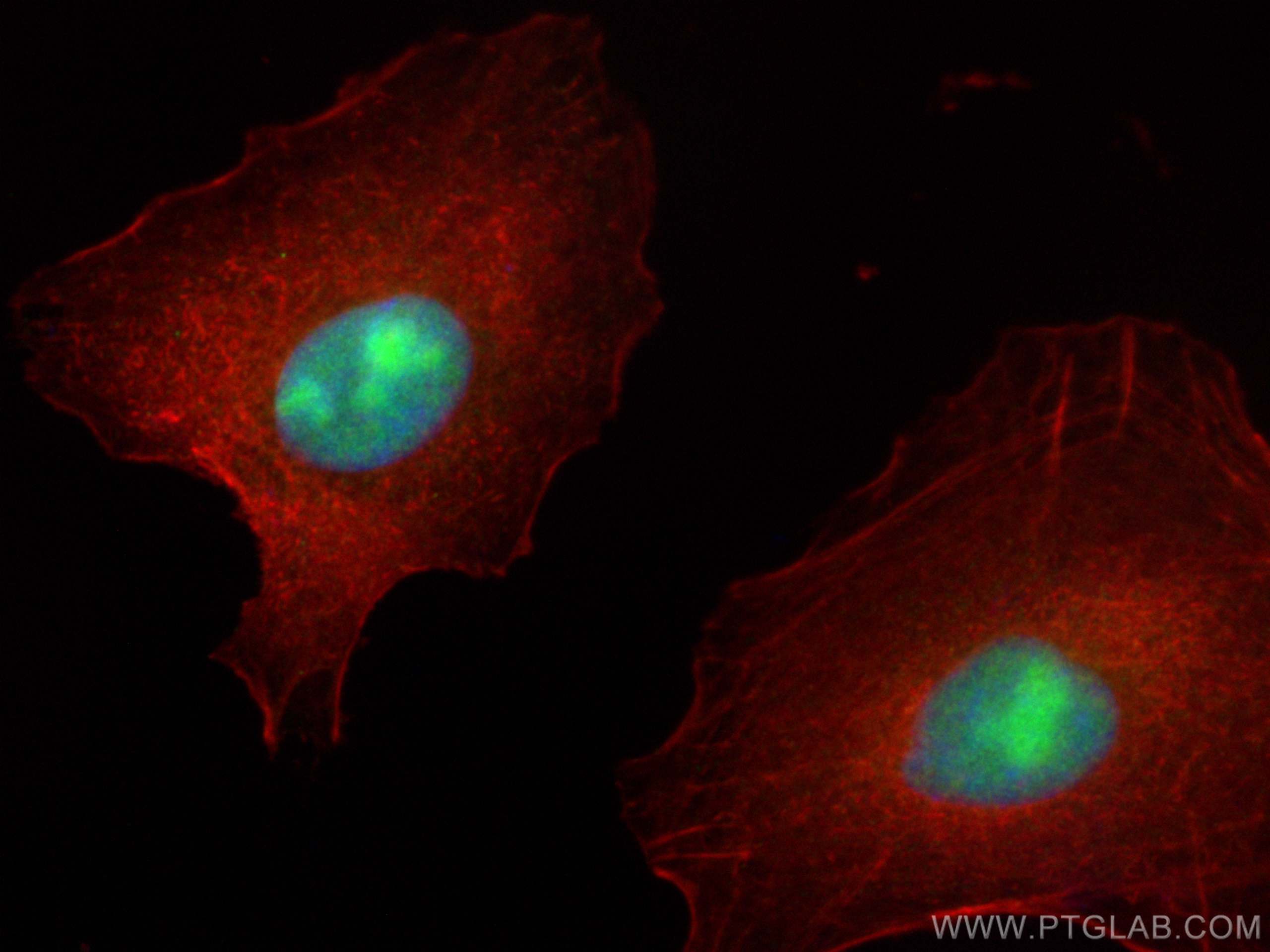 Immunofluorescence (IF) / fluorescent staining of A549 cells using ECT2 Polyclonal antibody (26557-1-AP)