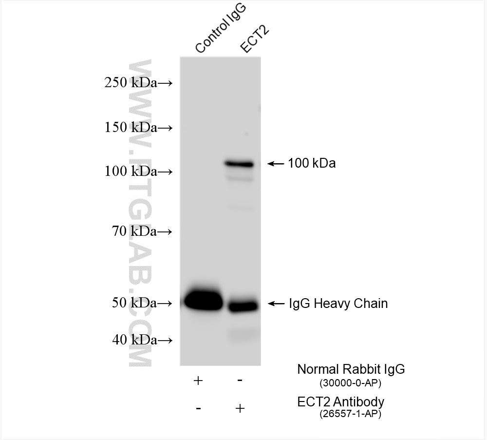 Immunoprecipitation (IP) experiment of K-562 cells using ECT2 Polyclonal antibody (26557-1-AP)