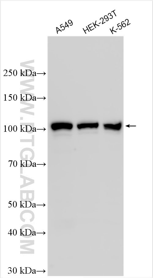 Western Blot (WB) analysis of various lysates using ECT2 Polyclonal antibody (26557-1-AP)