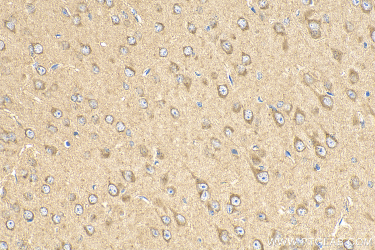 Immunohistochemistry (IHC) staining of mouse brain tissue using EEA1 Polyclonal antibody (28347-1-AP)