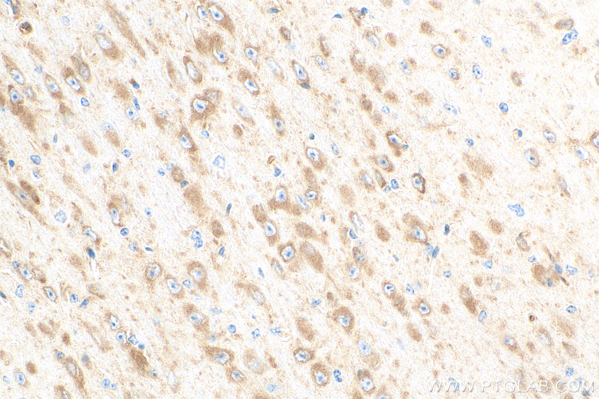 Immunohistochemistry (IHC) staining of mouse brain tissue using EEA1 Monoclonal antibody (68065-1-Ig)