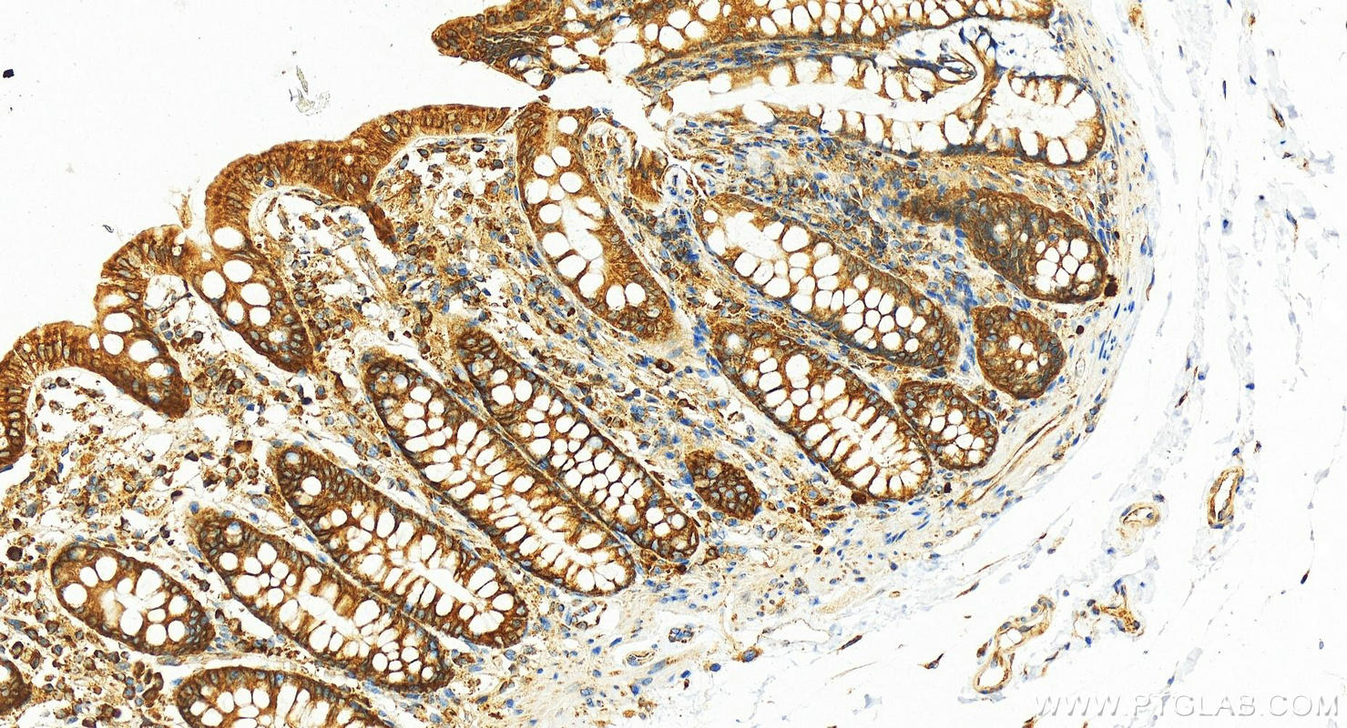 Immunohistochemistry (IHC) staining of human colon tissue using EEF1A1 Recombinant antibody (81377-1-RR)