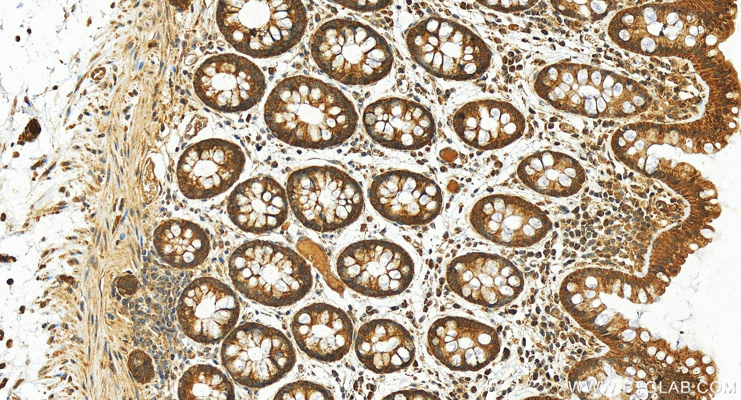 Immunohistochemistry (IHC) staining of human  colon using EEF1A2 Polyclonal antibody (16091-1-AP)