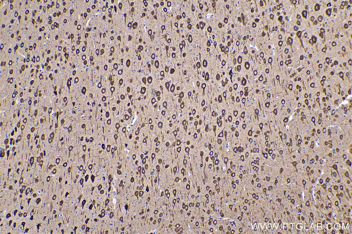 Immunohistochemistry (IHC) staining of rat brain tissue using EEF1A2 Monoclonal antibody (66806-1-Ig)