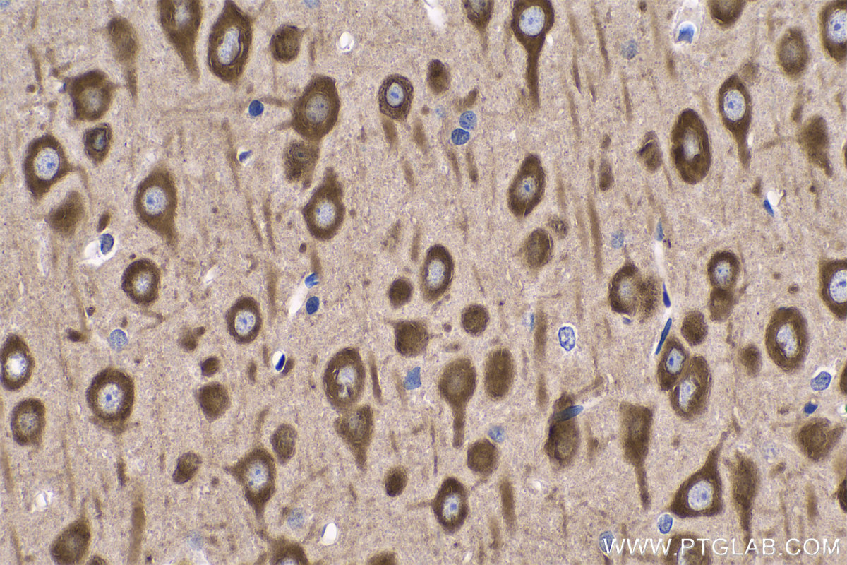 Immunohistochemistry (IHC) staining of rat brain tissue using EEF1A2 Monoclonal antibody (66806-1-Ig)