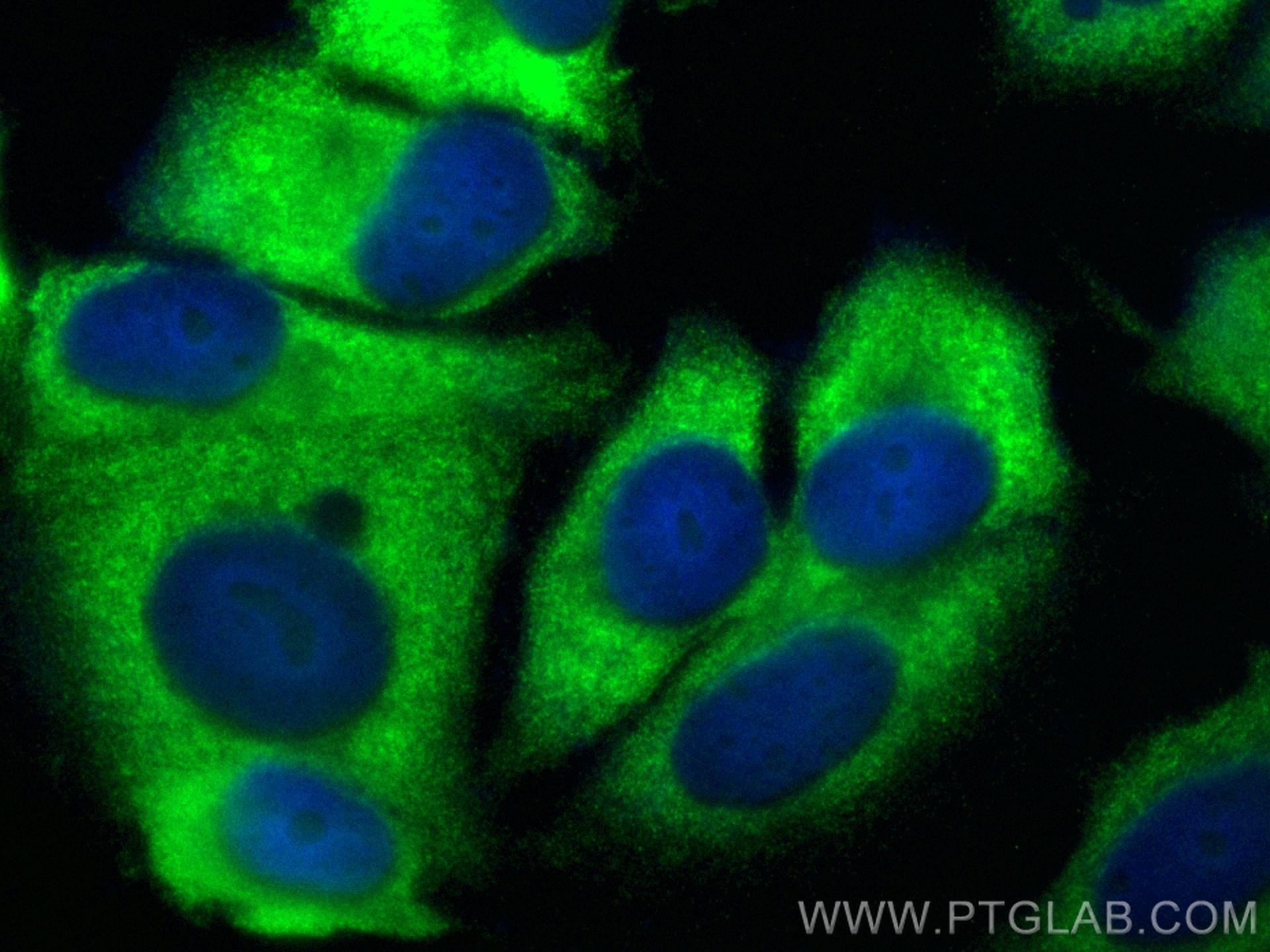 Immunofluorescence (IF) / fluorescent staining of MCF-7 cells using EEF1B2 Polyclonal antibody (10095-2-AP)