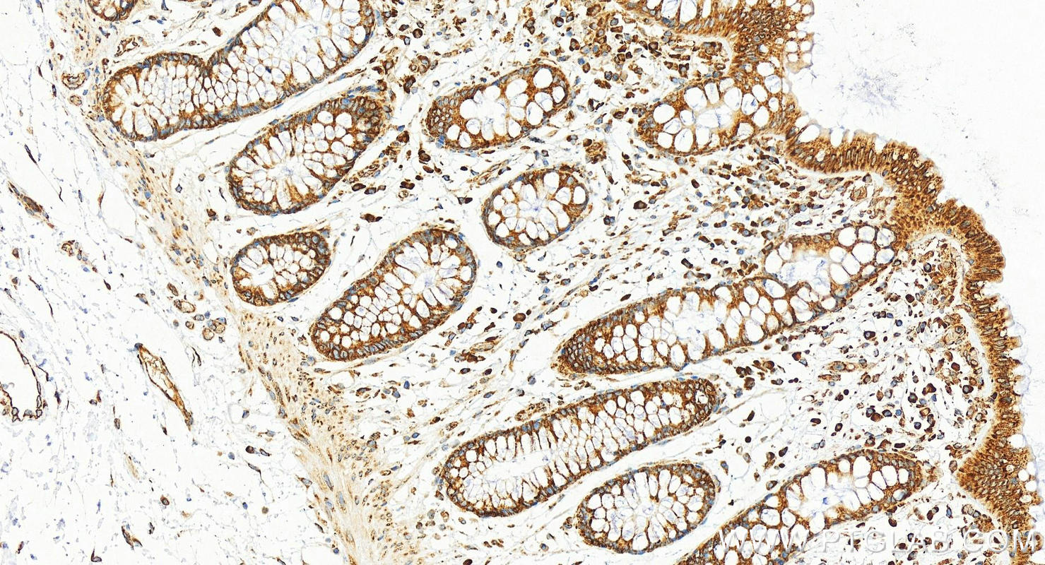 Immunohistochemistry (IHC) staining of human colon tissue using EEF1B2 Monoclonal antibody (60329-1-Ig)