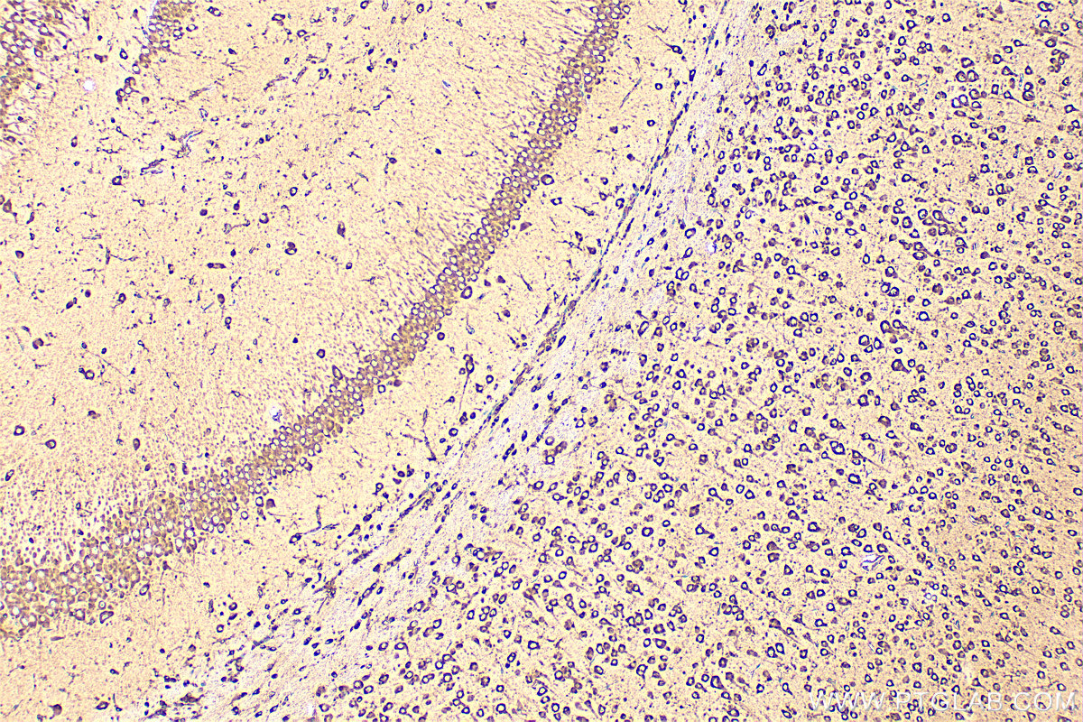 Immunohistochemistry (IHC) staining of mouse brain tissue using EEF1D Polyclonal antibody (10630-1-AP)