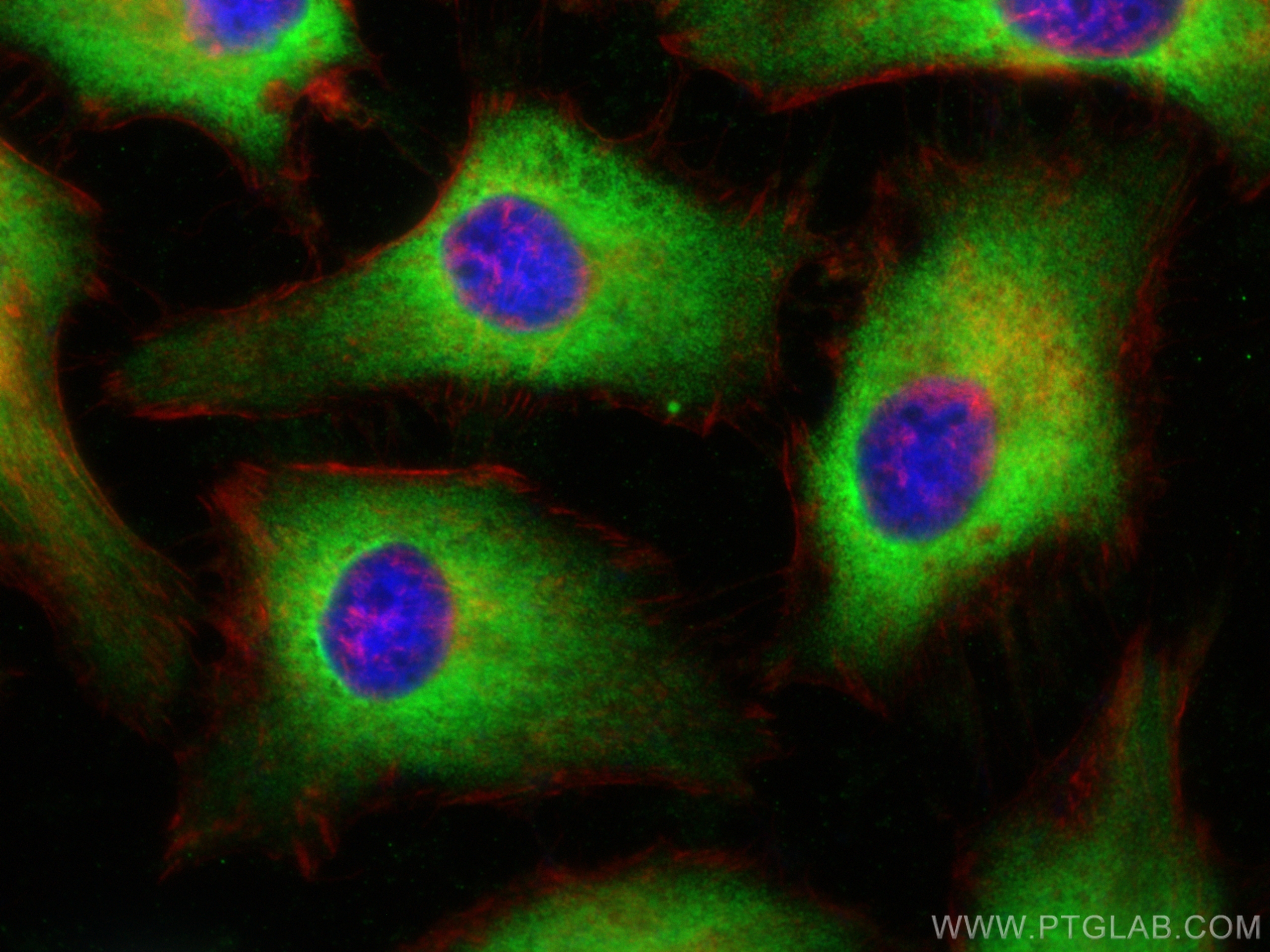 Immunofluorescence (IF) / fluorescent staining of HeLa cells using EEF1D Monoclonal antibody (60085-1-Ig)