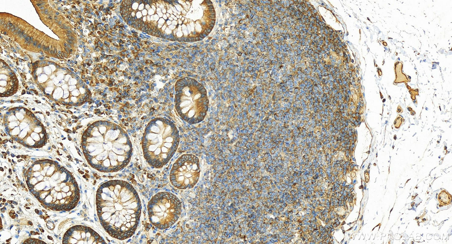 Immunohistochemistry (IHC) staining of human normal colon using EEF2 Polyclonal antibody (20107-1-AP)