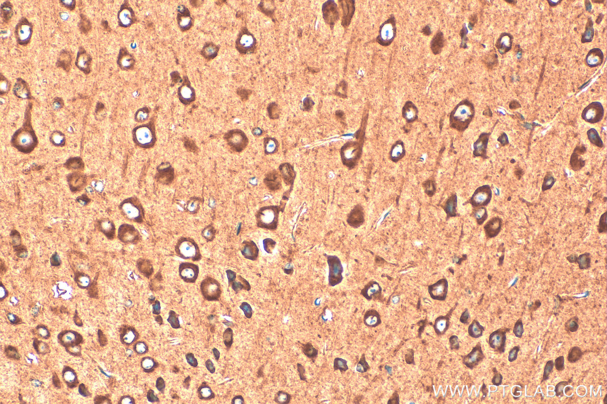 Immunohistochemistry (IHC) staining of mouse brain tissue using EEF2 Polyclonal antibody (20107-1-AP)