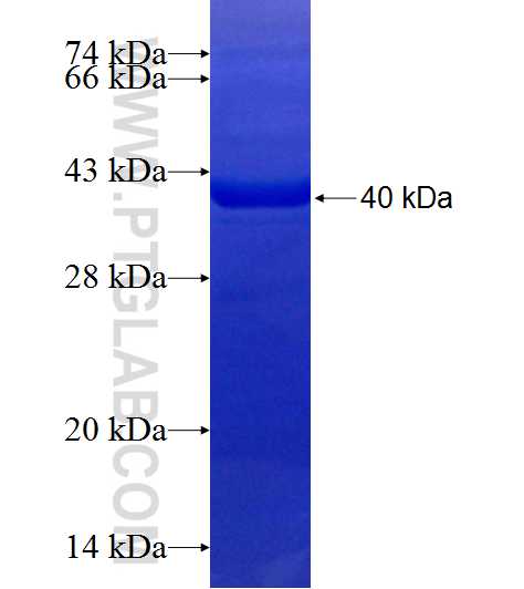 EEPD1 fusion protein Ag19489 SDS-PAGE