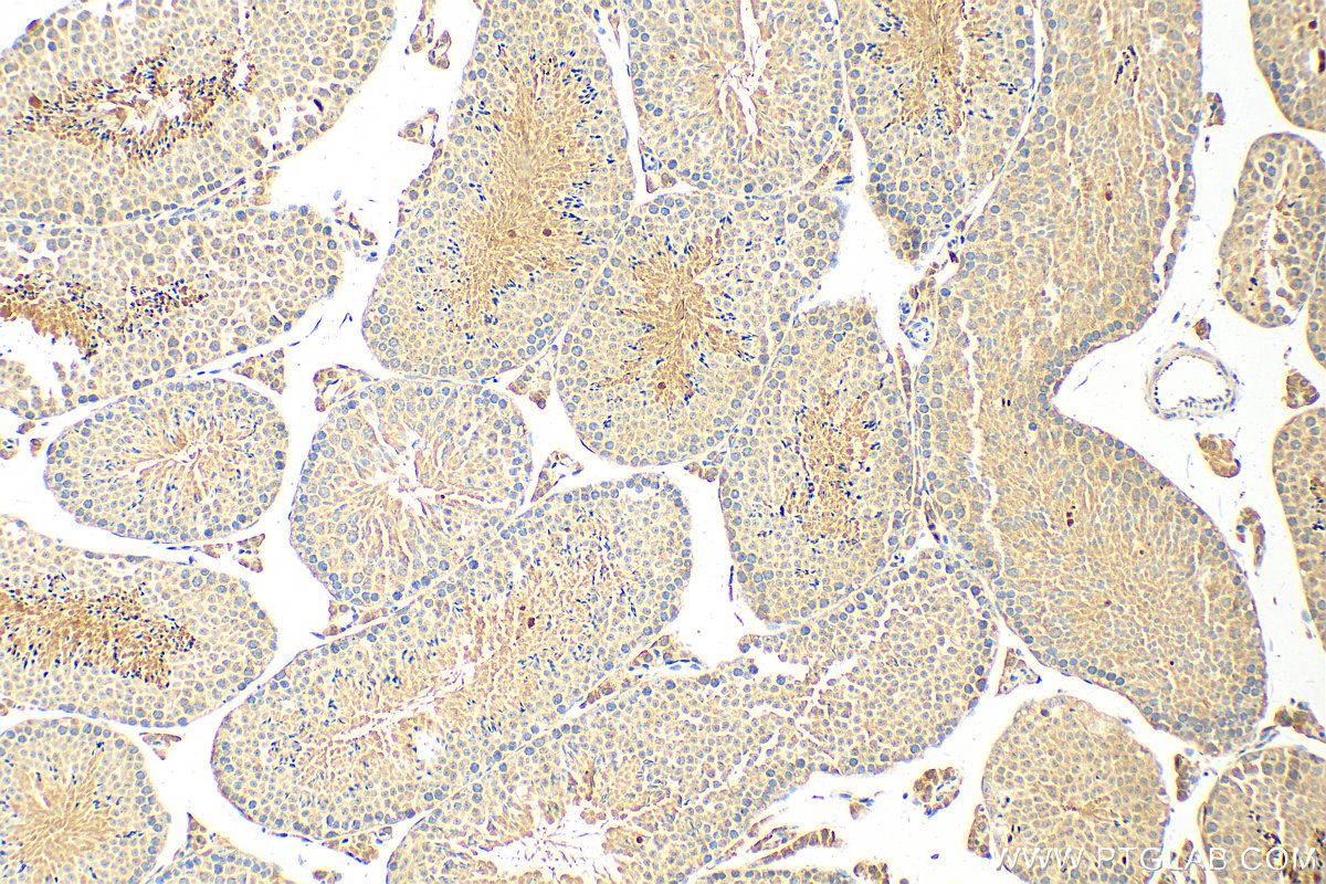 Immunohistochemistry (IHC) staining of mouse testis tissue using EFCAB1 Polyclonal antibody (17276-1-AP)