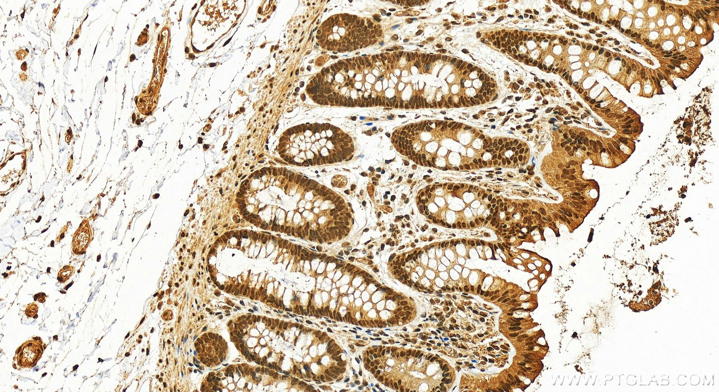 Immunohistochemistry (IHC) staining of human colon tissue using EFCAB5 Polyclonal antibody (24296-1-AP)