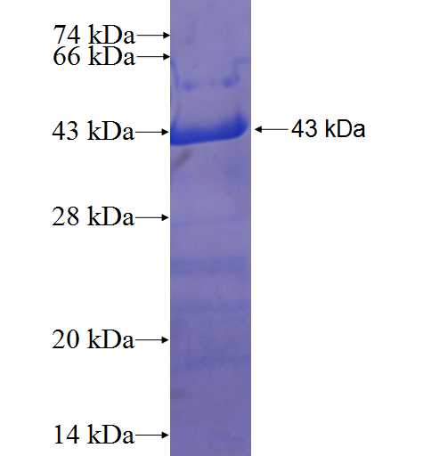 EFCAB6 fusion protein Ag22377 SDS-PAGE