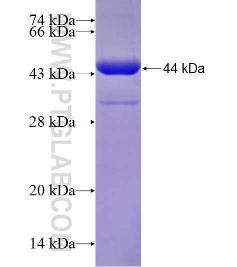 EFHC1 fusion protein Ag28989 SDS-PAGE