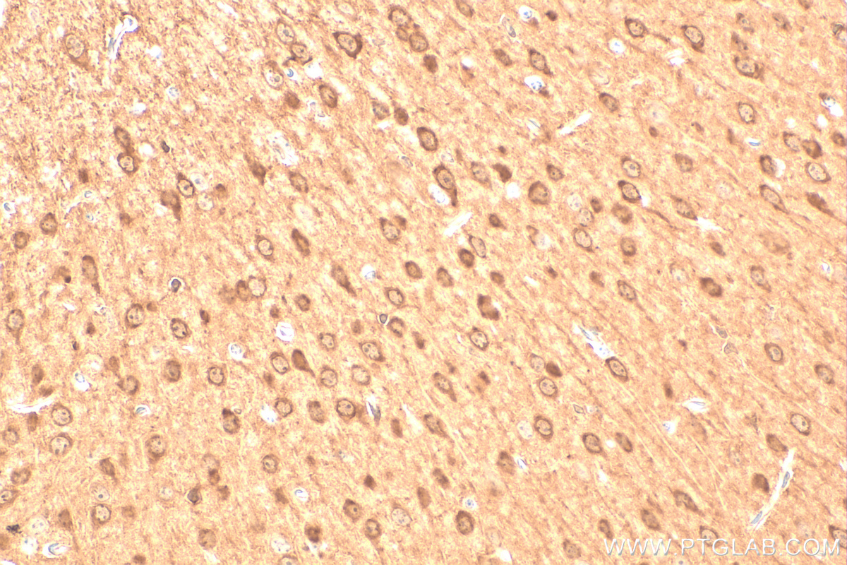 Immunohistochemistry (IHC) staining of mouse brain tissue using EFHD2 Polyclonal antibody (31624-1-AP)