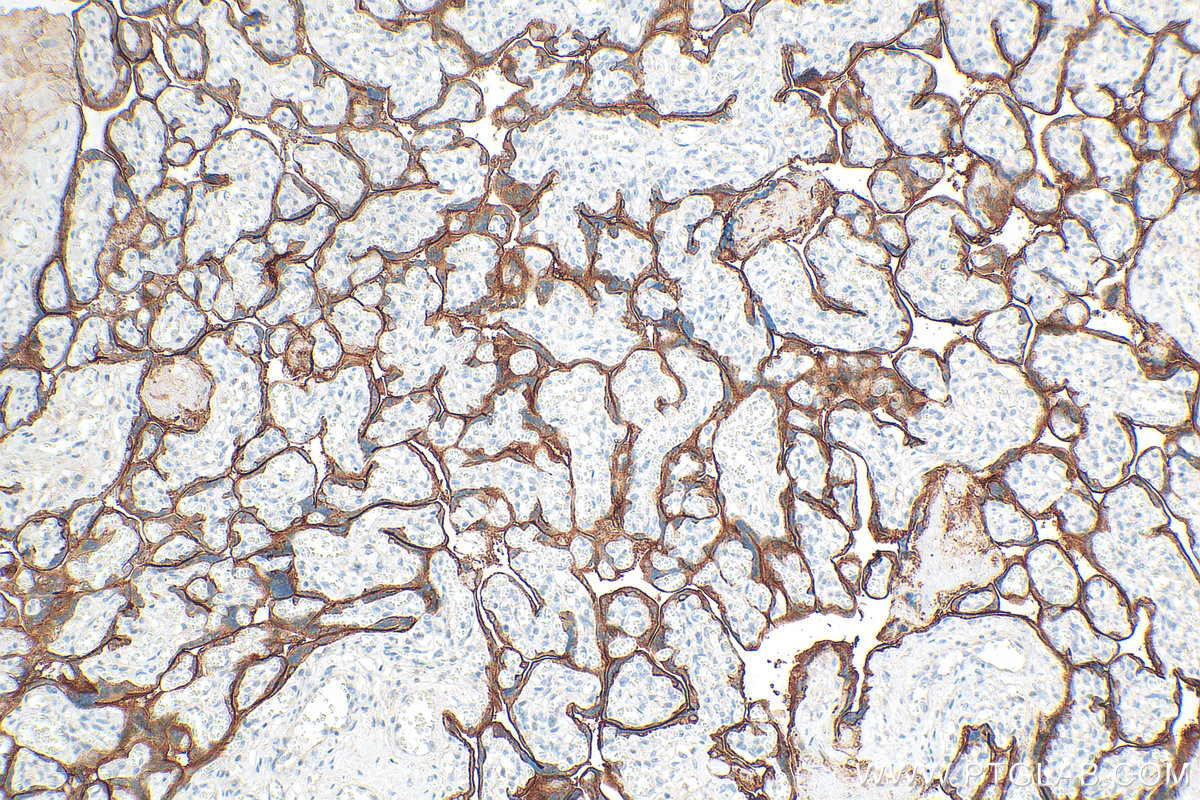 Immunohistochemistry (IHC) staining of human placenta tissue using EGFR Monoclonal antibody (66455-1-Ig)