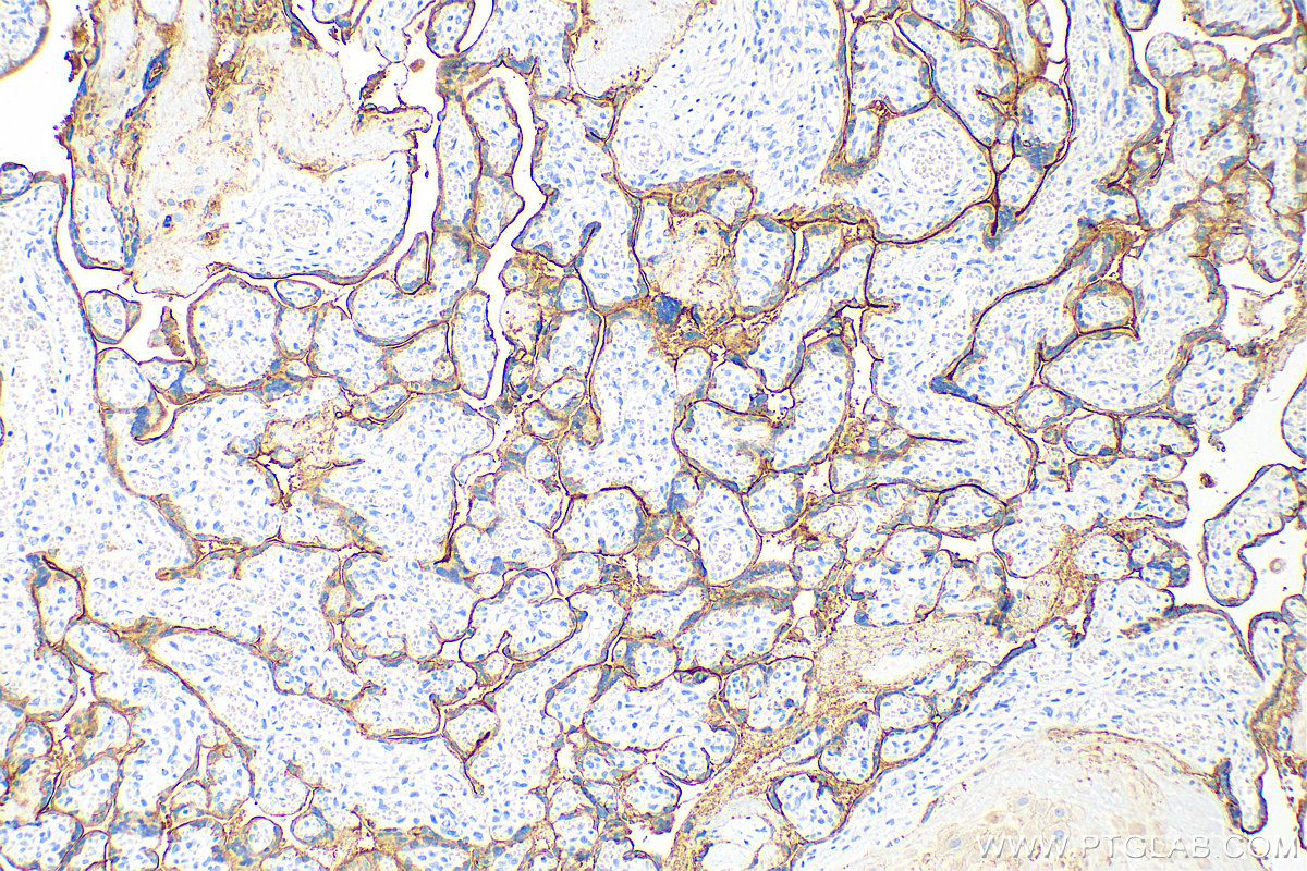 Immunohistochemistry (IHC) staining of human placenta tissue using EGFR Monoclonal antibody (66455-1-Ig)