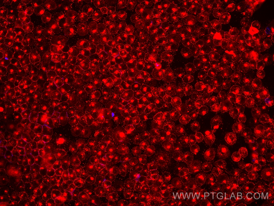 Immunofluorescence (IF) / fluorescent staining of A431 cells using EGFR Monoclonal antibody (68643-1-Ig)