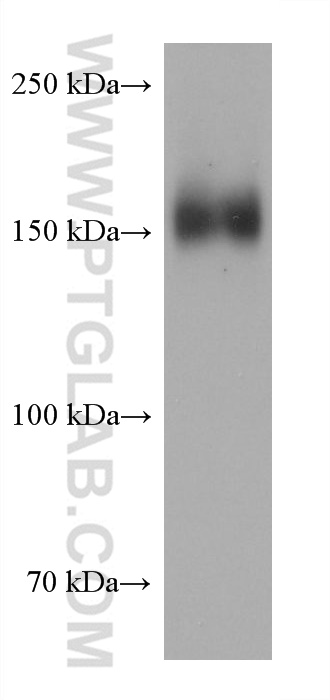 Western Blot (WB) analysis of MDA-MB-468 cells using EGFR Monoclonal antibody (68643-1-Ig)